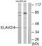 ELAV Like RNA Binding Protein 2 antibody, TA313805, Origene, Western Blot image 