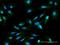 Jupiter Microtubule Associated Homolog 2 antibody, H00090861-M05, Novus Biologicals, Immunocytochemistry image 