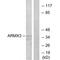 Armadillo Repeat Containing X-Linked 3 antibody, MBS9406174, MyBioSource, Western Blot image 