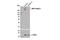 ATP Binding Cassette Subfamily C Member 1 antibody, 14685S, Cell Signaling Technology, Western Blot image 