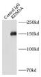 Jhdm2a antibody, FNab04510, FineTest, Immunoprecipitation image 