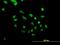 PHD Finger Protein 10 antibody, H00055274-B01P, Novus Biologicals, Immunocytochemistry image 