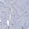 Tyrosyl-TRNA Synthetase antibody, HPA018954, Atlas Antibodies, Immunohistochemistry frozen image 