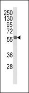Aldehyde Dehydrogenase 3 Family Member B1 antibody, MBS9214855, MyBioSource, Western Blot image 