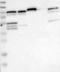 Lgp2 antibody, NBP1-85349, Novus Biologicals, Western Blot image 