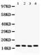 Caveolin 2 antibody, LS-C344023, Lifespan Biosciences, Western Blot image 