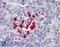 Von Hippel-Lindau disease tumor suppressor antibody, LS-B2927, Lifespan Biosciences, Immunohistochemistry paraffin image 