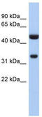 Sulfotransferase Family 1B Member 1 antibody, TA346772, Origene, Western Blot image 