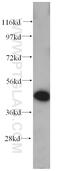 Casein kinase I isoform delta antibody, 14388-1-AP, Proteintech Group, Western Blot image 