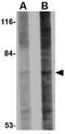 GLE1 RNA Export Mediator antibody, GTX31368, GeneTex, Western Blot image 