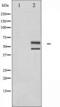 Mitogen-Activated Protein Kinase 8 antibody, TA325661, Origene, Western Blot image 