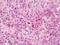 Vascular Endothelial Growth Factor C antibody, orb96094, Biorbyt, Immunohistochemistry paraffin image 