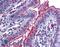 Fms Related Tyrosine Kinase 4 antibody, LS-B6053, Lifespan Biosciences, Immunohistochemistry paraffin image 
