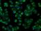Nitrilase 1 antibody, MA5-25068, Invitrogen Antibodies, Immunocytochemistry image 