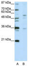 Zinc Finger Protein 57 antibody, TA345592, Origene, Western Blot image 