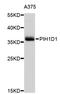 PIH1 domain-containing protein 1 antibody, STJ26305, St John