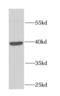 Four And A Half LIM Domains 1 antibody, FNab03109, FineTest, Western Blot image 