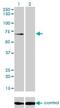 Polypeptide N-acetylgalactosaminyltransferase 6 antibody, H00011226-M01, Novus Biologicals, Western Blot image 