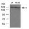 Early Endosome Antigen 1 antibody, GTX50769, GeneTex, Western Blot image 