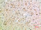 CD16 antibody, A01408, Boster Biological Technology, Immunohistochemistry paraffin image 