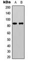Catenin Beta 1 antibody, MBS8206297, MyBioSource, Western Blot image 