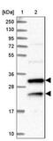 Multivesicular Body Subunit 12A antibody, NBP1-91882, Novus Biologicals, Western Blot image 