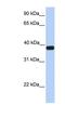 Ankyrin Repeat And SOCS Box Containing 5 antibody, NBP1-59065, Novus Biologicals, Western Blot image 