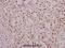 Protein hairless antibody, A04817-2, Boster Biological Technology, Immunohistochemistry frozen image 