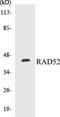 RAD52 Homolog, DNA Repair Protein antibody, EKC1494, Boster Biological Technology, Western Blot image 