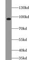 ArfGAP With Coiled-Coil, Ankyrin Repeat And PH Domains 3 antibody, FNab00071, FineTest, Western Blot image 