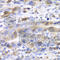 Ubiquitin-conjugating enzyme E2 C antibody, A5499, ABclonal Technology, Immunohistochemistry paraffin image 
