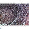 Major Histocompatibility Complex, Class II, DM Beta antibody, LS-C814240, Lifespan Biosciences, Immunohistochemistry paraffin image 