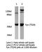 FYN Proto-Oncogene, Src Family Tyrosine Kinase antibody, LS-C175892, Lifespan Biosciences, Western Blot image 