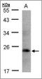 Somatotropin antibody, AP23152PU-N, Origene, Western Blot image 