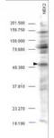 NIMA Related Kinase 2 antibody, TA319262, Origene, Western Blot image 