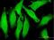 Actin Binding Transcription Modulator antibody, H00054942-B01P, Novus Biologicals, Immunofluorescence image 
