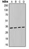 Dynactin Subunit 2 antibody, orb214999, Biorbyt, Western Blot image 