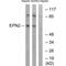 Epsin 2 antibody, PA5-50030, Invitrogen Antibodies, Western Blot image 