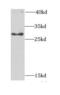 Bisphosphoglycerate mutase antibody, FNab00934, FineTest, Western Blot image 