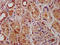 SUZ12 Polycomb Repressive Complex 2 Subunit antibody, LS-C679708, Lifespan Biosciences, Immunohistochemistry paraffin image 