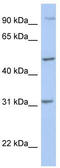 Protein Phosphatase, Mg2+/Mn2+ Dependent 1J antibody, TA335086, Origene, Western Blot image 