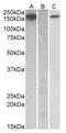 FMS antibody, AP22414PU-N, Origene, Western Blot image 