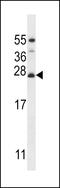Mitochondrial Ribosomal Protein L50 antibody, 56-740, ProSci, Western Blot image 