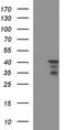Homocysteine Inducible ER Protein With Ubiquitin Like Domain 1 antibody, LS-C788409, Lifespan Biosciences, Western Blot image 