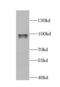 AT-Rich Interaction Domain 3A antibody, FNab00566, FineTest, Western Blot image 
