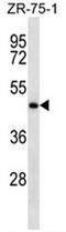 Ig epsilon chain C region antibody, AP52167PU-N, Origene, Western Blot image 