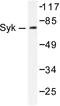 Spleen Associated Tyrosine Kinase antibody, AP06335PU-N, Origene, Western Blot image 