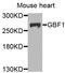 Golgi Brefeldin A Resistant Guanine Nucleotide Exchange Factor 1 antibody, orb374148, Biorbyt, Western Blot image 