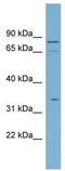 Sodium/glucose cotransporter 4 antibody, TA334145, Origene, Western Blot image 