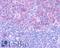 C-C Motif Chemokine Receptor 3 antibody, LS-A1386, Lifespan Biosciences, Immunohistochemistry frozen image 